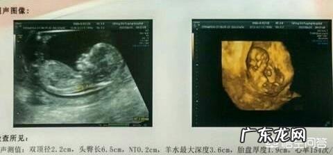 怀孕快三个月时会感觉到肚子里的宝宝在动,是胎动吗?