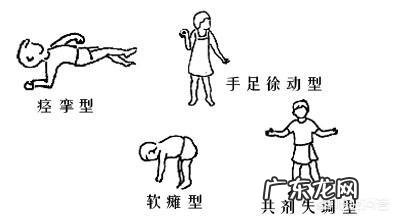 脑瘫的早期症状有哪些?