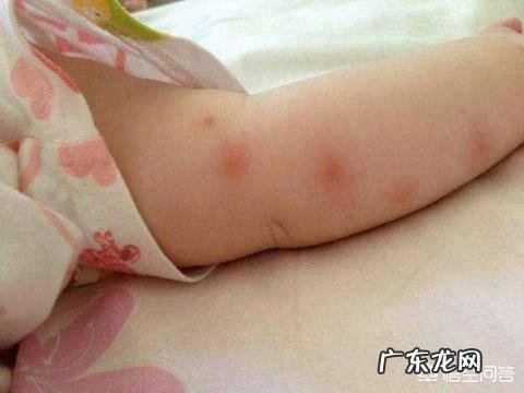 宝宝夏天外出怎么防蚊子？