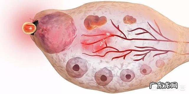 怎么测排卵？排卵的时候会有什么症状吗？