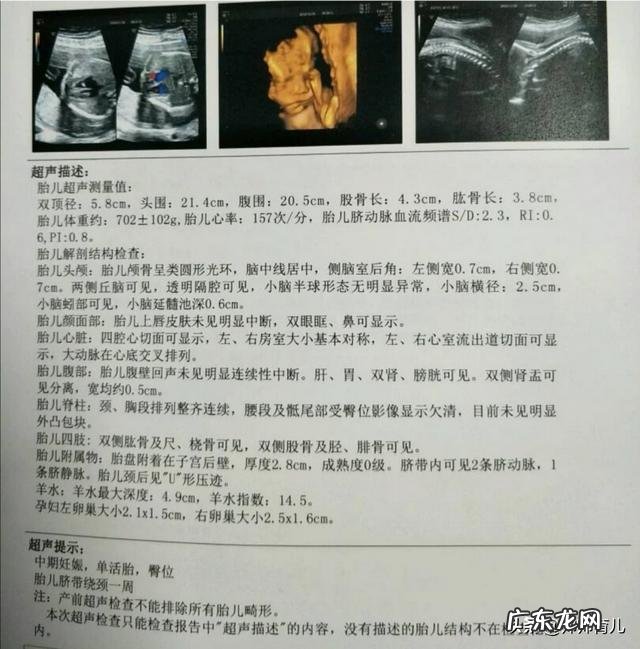 怀孕六个月的孕妇需要注意什么问题?