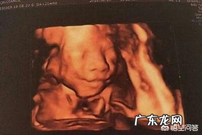 怀孕6个月,宝宝的四维拍照嘴巴和鼻子都好大,生出来后是不是很丑?为什么?
