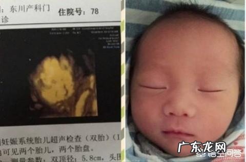 怀孕6个月,宝宝的四维拍照嘴巴和鼻子都好大,生出来后是不是很丑?为什么?