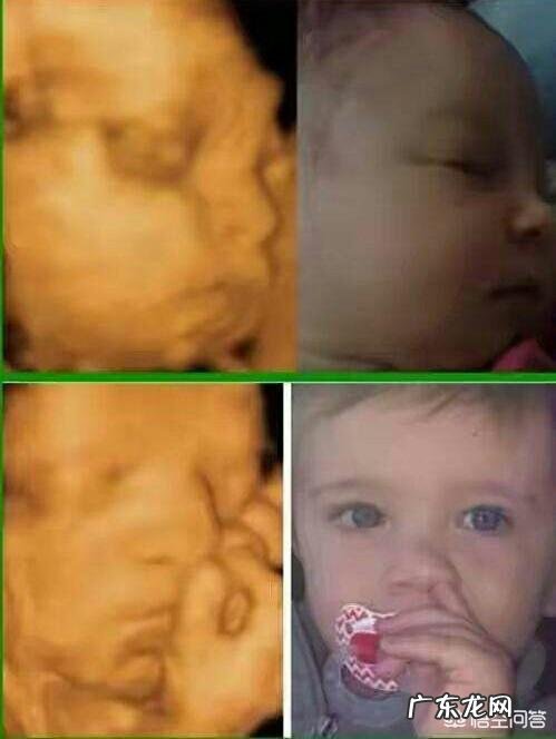 怀孕6个月,宝宝的四维拍照嘴巴和鼻子都好大,生出来后是不是很丑?为什么?