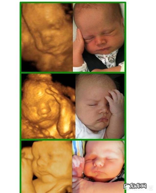 怀孕6个月,宝宝的四维拍照嘴巴和鼻子都好大,生出来后是不是很丑?为什么?