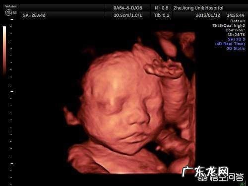 怀孕6个月,宝宝的四维拍照嘴巴和鼻子都好大,生出来后是不是很丑?为什么?