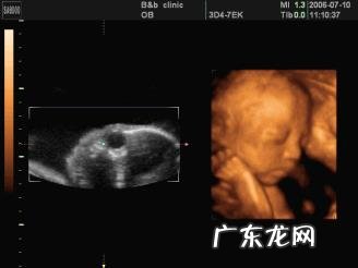 怀孕6个月,宝宝的四维拍照嘴巴和鼻子都好大,生出来后是不是很丑?为什么?