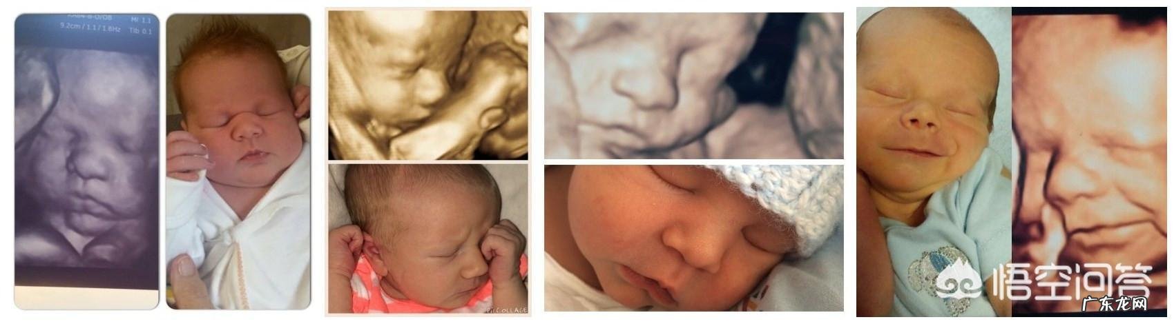 怀孕6个月,宝宝的四维拍照嘴巴和鼻子都好大,生出来后是不是很丑?为什么?