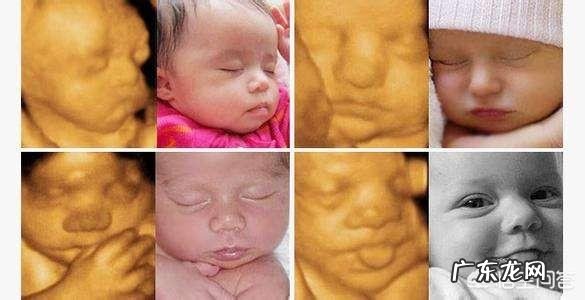 怀孕6个月,宝宝的四维拍照嘴巴和鼻子都好大,生出来后是不是很丑?为什么?