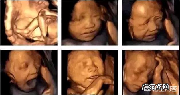 怀孕6个月，宝宝的四维拍照嘴巴和鼻子都好大，生出来后是不是很丑？为什么？