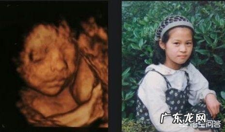 怀孕6个月,宝宝的四维拍照嘴巴和鼻子都好大,生出来后是不是很丑?为什么?