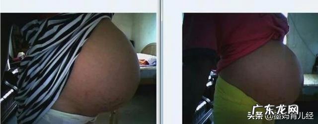 怀孕33周,最近肚子有下坠感,是胎儿入盆了吗?入盆有啥感觉?