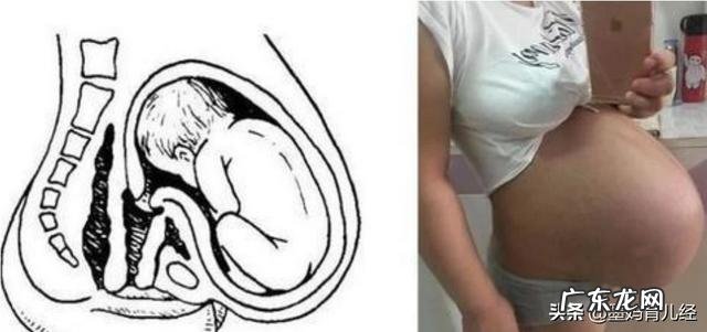 怀孕33周,最近肚子有下坠感,是胎儿入盆了吗?入盆有啥感觉?