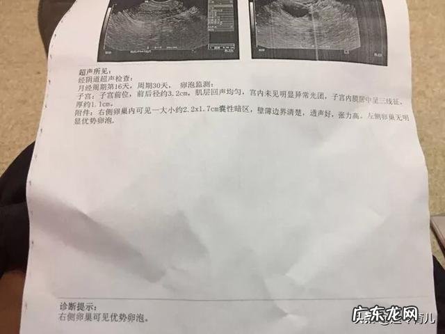 排卵期内没有“白带拉丝”，这意味着没有排卵吗？该怎么办？