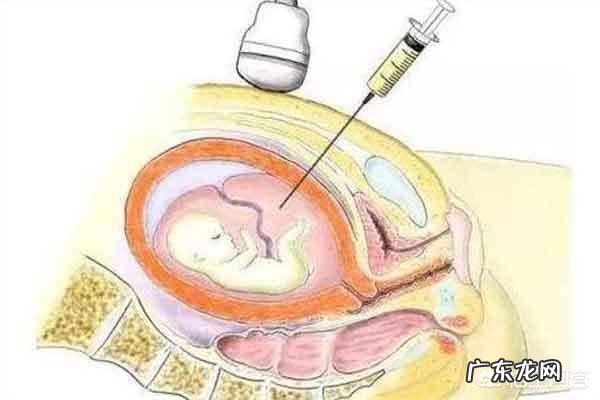 怀孕期间有什么方法可以做亲子鉴定？对胎儿有影响吗？
