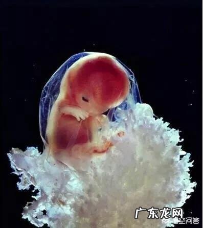 怀孕14周有点出血,这是什么原因?