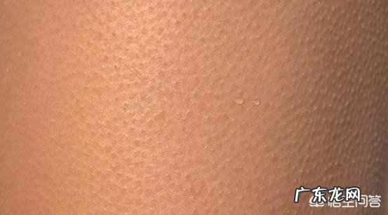 女生毛发过多怎么办?