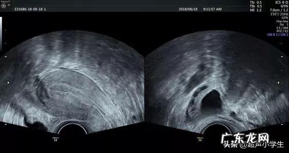 月经后几天是排卵期?