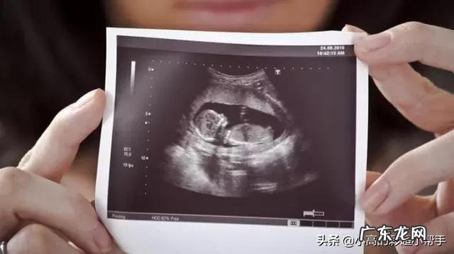 怀孕3个月胎儿成形了吗?需要注意哪些问题?