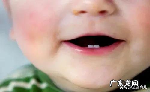 为什么有的婴儿一出生就有牙齿?