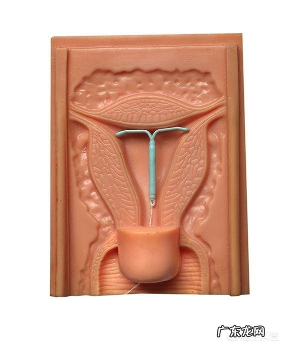 取环后多长时间能怀孕?