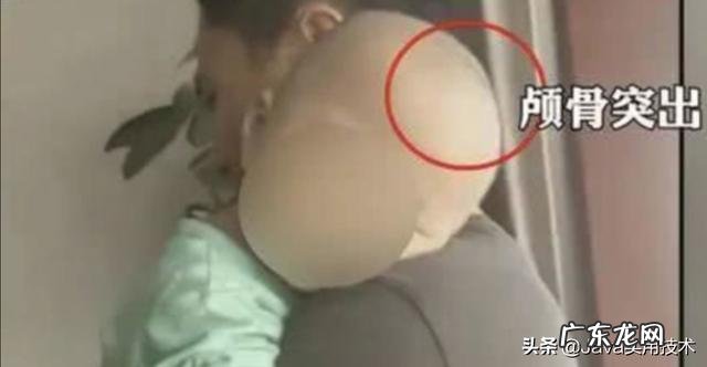 喝奶粉成大头娃娃厂家却说产品合格如何揭秘假奶粉销售内幕?