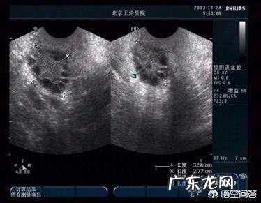 备孕时候多吃什么食物可以促进卵泡生长?