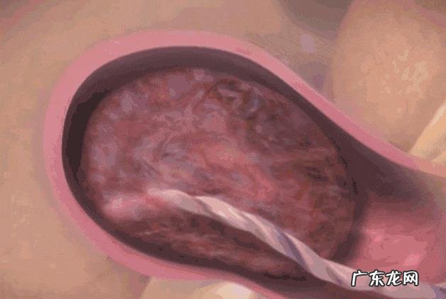 孕妇分娩时胎儿在干嘛?