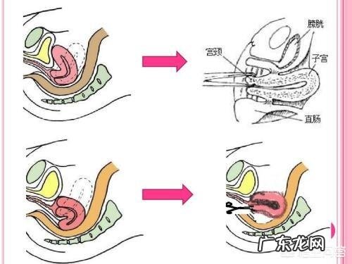 打胎后要注意什么?