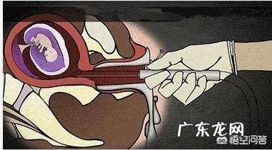 打胎后要注意什么?