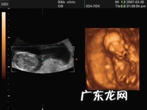 孕妇做个四维彩超要多长时间?