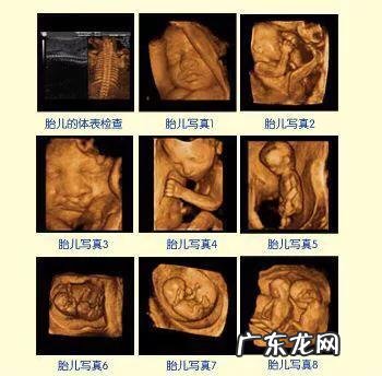 孕妇做个四维彩超要多长时间?