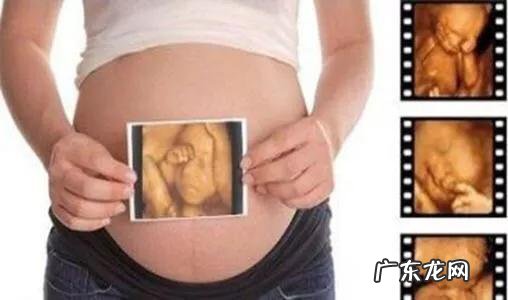 孕妇做个四维彩超要多长时间?