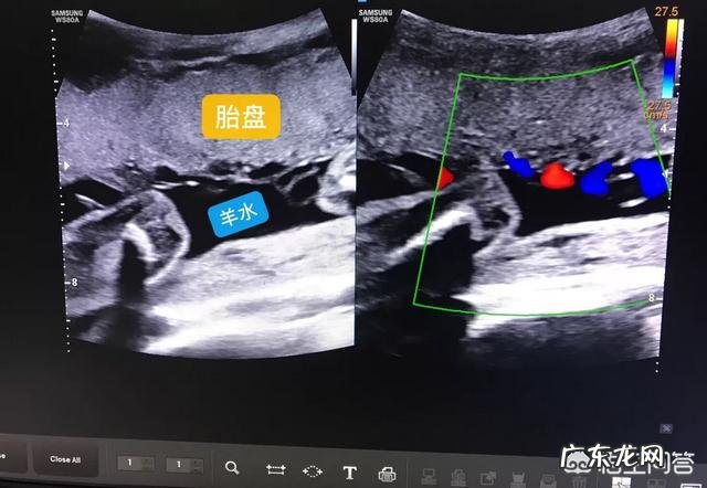 孕妇做个四维彩超要多长时间?