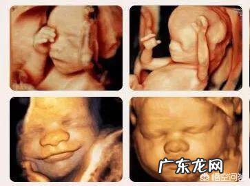 孕妇做个四维彩超要多长时间?