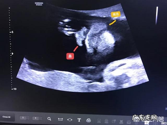 孕妇做个四维彩超要多长时间?