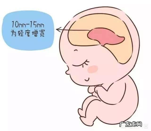 孕妇做个四维彩超要多长时间?