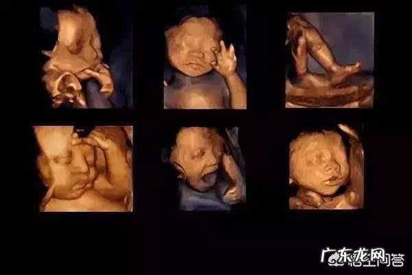 孕妇做个四维彩超要多长时间?