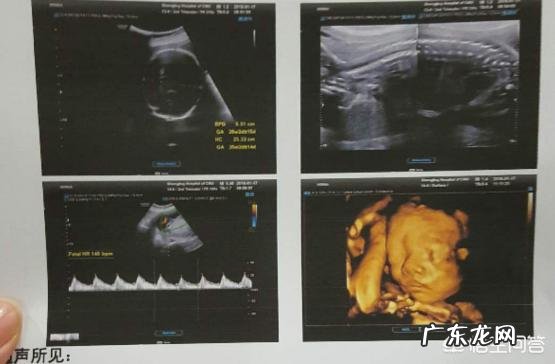 孕妇怀孕3个月后应该做什么检查?应该注意什么?