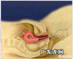 做完人流需要休息多久?有哪些需要注意的?