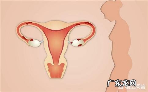 卵巢肿瘤的早期症状有哪些?