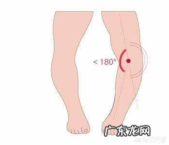 什么运动可以矫正罗圈腿？