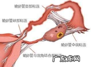 是什么原因造成输卵管的堵塞?