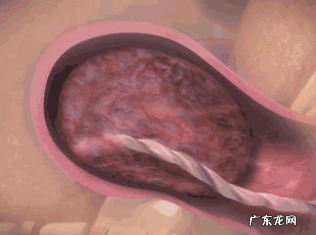 自然分娩的三个产程,宝妈都了解吗?