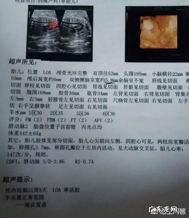 现在的宝妈在孕期做了哪些检查?