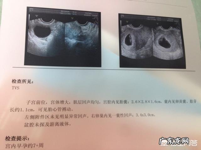 胎芽、胎心多长时间有?