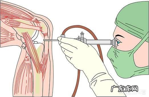 膝关节骨性关节炎怎么治疗比较好?