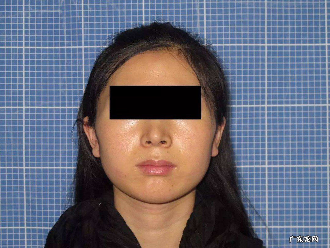 怎么瘦脸两边的肉最快