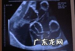 孕5个月的胎儿会是什么样子的?