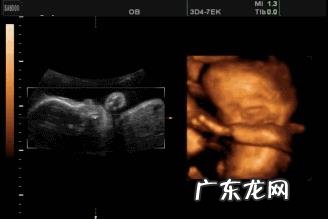 孕5个月的胎儿会是什么样子的?